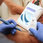 Electrolisis percutánea imagen 1