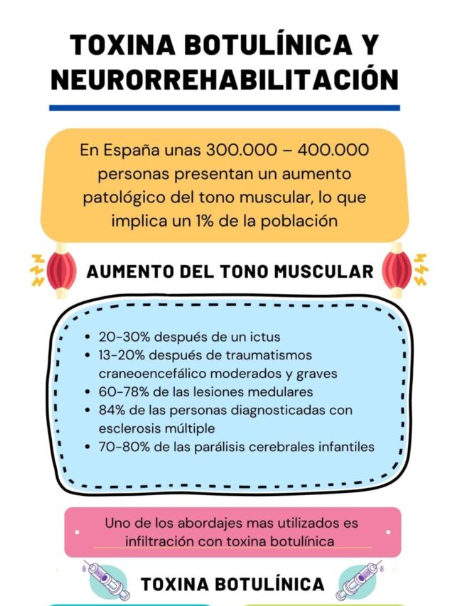 Toxina botulínica y neurorrehabilitación